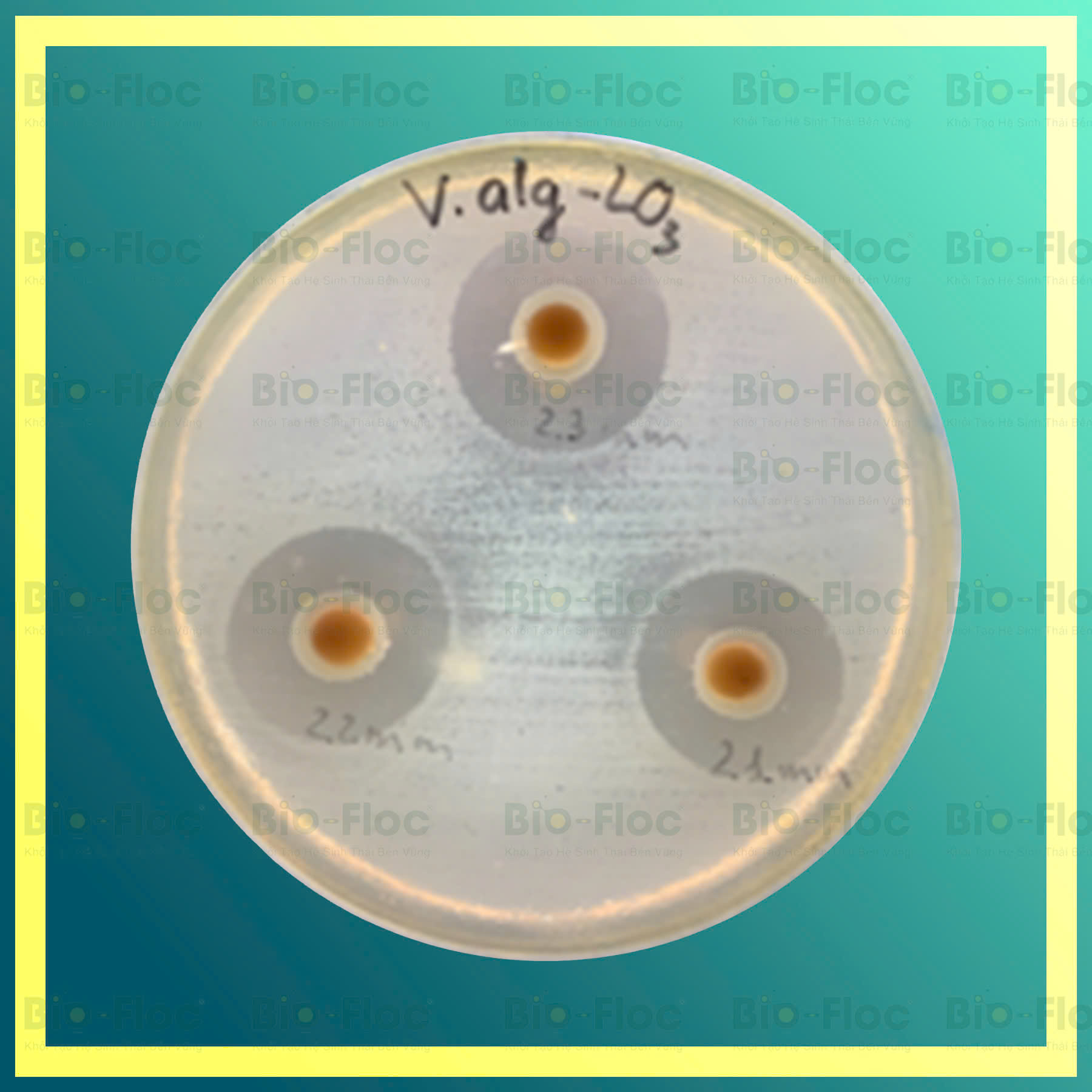 vi khuẩn Lactobacillus