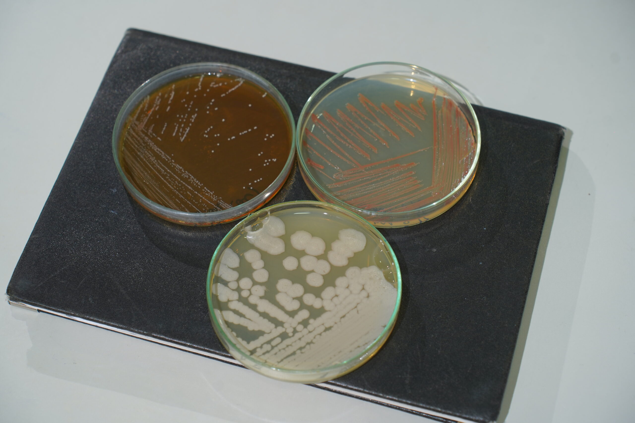 chế phẩm vi sinh bản địa